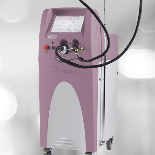 VBEAM PERFECTA CANDELA